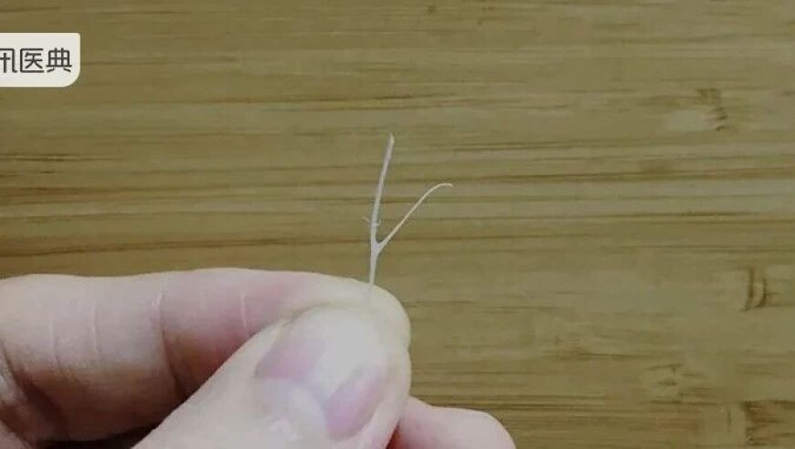 代表建议完善反家暴机制,澳门最准的一肖一码,完美答案解释落实_影像版V6.76